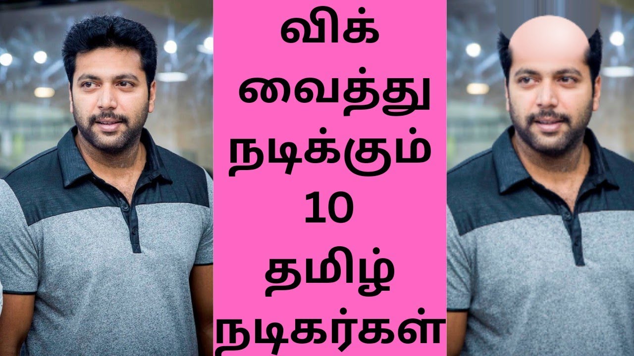 சொட்டை தலையும் பத்து தமிழ் நடிகர்களும் | Top 10 Tamil Actors Acts with Wig#tamilactorshairtransplant