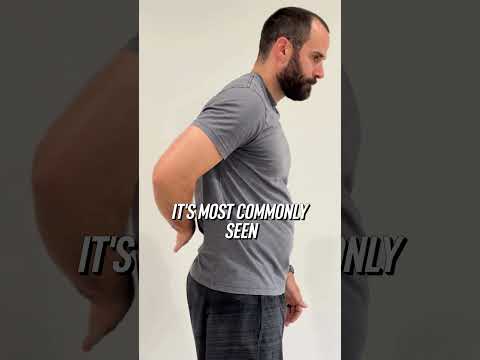 Shoulder Pain? Quick Tests to Identify Impingement, Tendonitis, or a Tear! #shorts