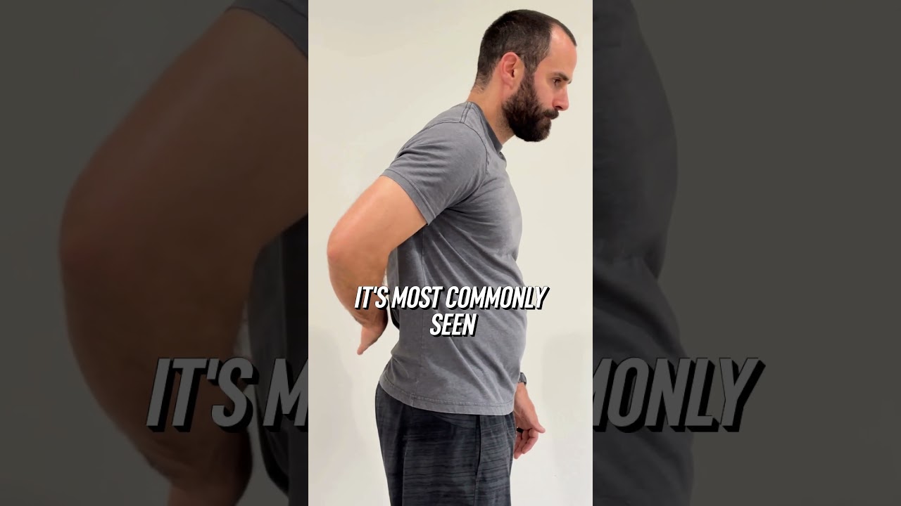 Shoulder Pain? 4 Easy Tests to Spot Impingement, Tendonitis & Tears! 🔍