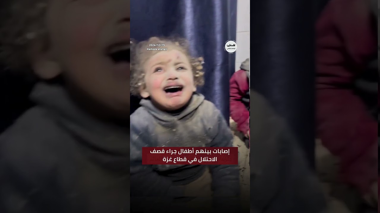 #شاهد إصابات بينهم أطفال جراء قصف الاحتلال في قطاع غزة