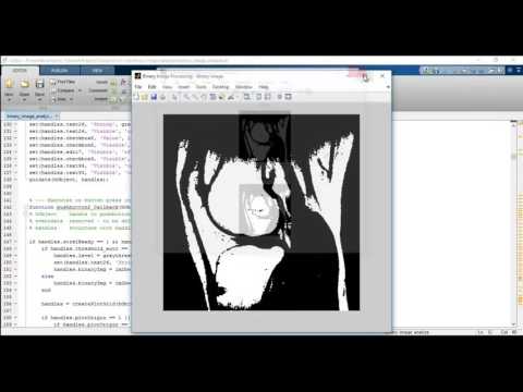 Digital image processing projects using matlab pdf
