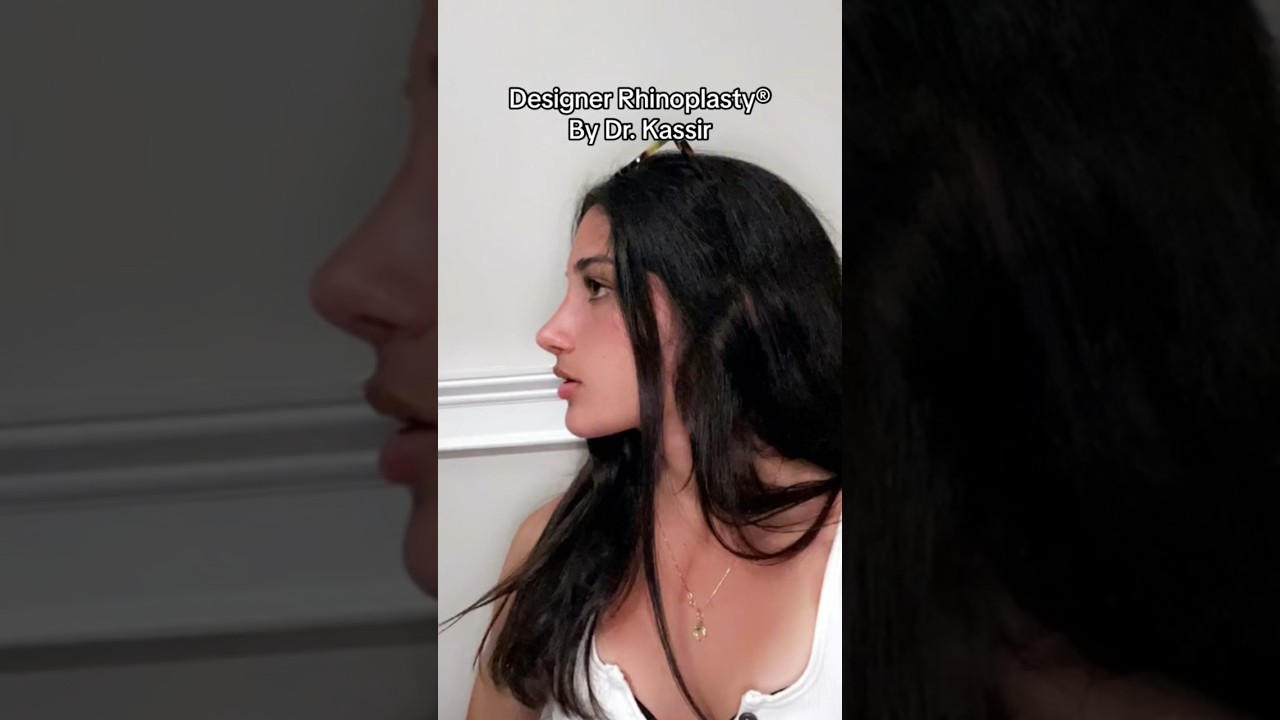 Top Nose Job Surgeon for Perfect Rhinoplasty 👃