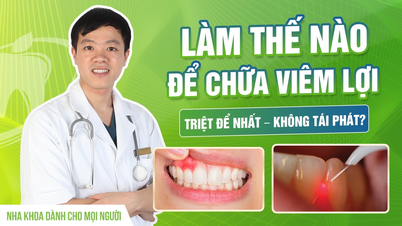 Điều trị viêm lợi bằng phương pháp cắt lợi Laser -