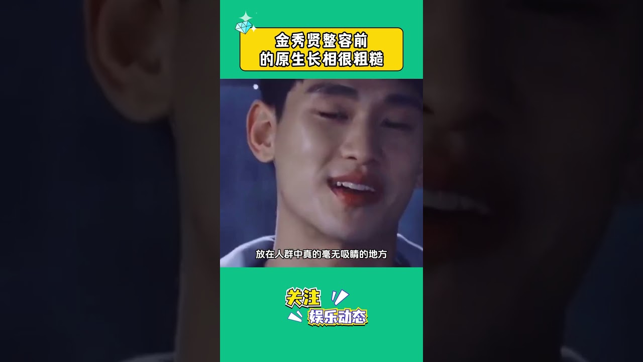 金秀賢整容前的自然樣貌曝光，原生長相令人驚訝！✨
