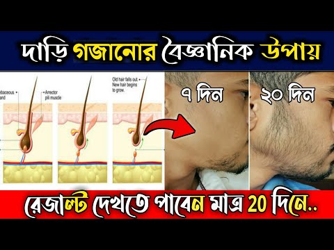 দাড়ি গজানোর উপায়- 😯 মাত্র ২০ দিনে।। Dari Gojanor Upay Bangla.
