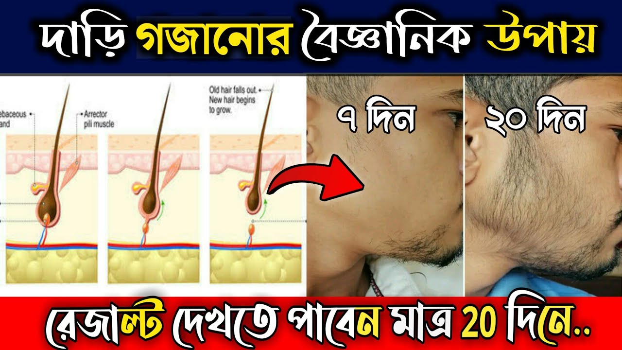 মাত্র ২০ দিনে চাপ দাড়ি গজানোর সহজ উপায়! 🧔
