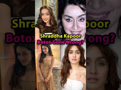 Shraddha Kapoor Botox Gone Wrong? #shraddhakapoor #botox #actress #bollywood #surgery