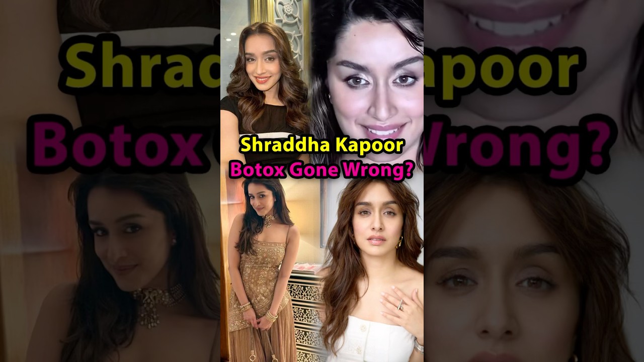 Did Shraddha Kapoor's Botox Experience Go Wrong? 🤔
