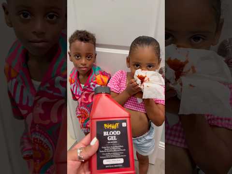 Londyn nose bleed prank on dad #shorts