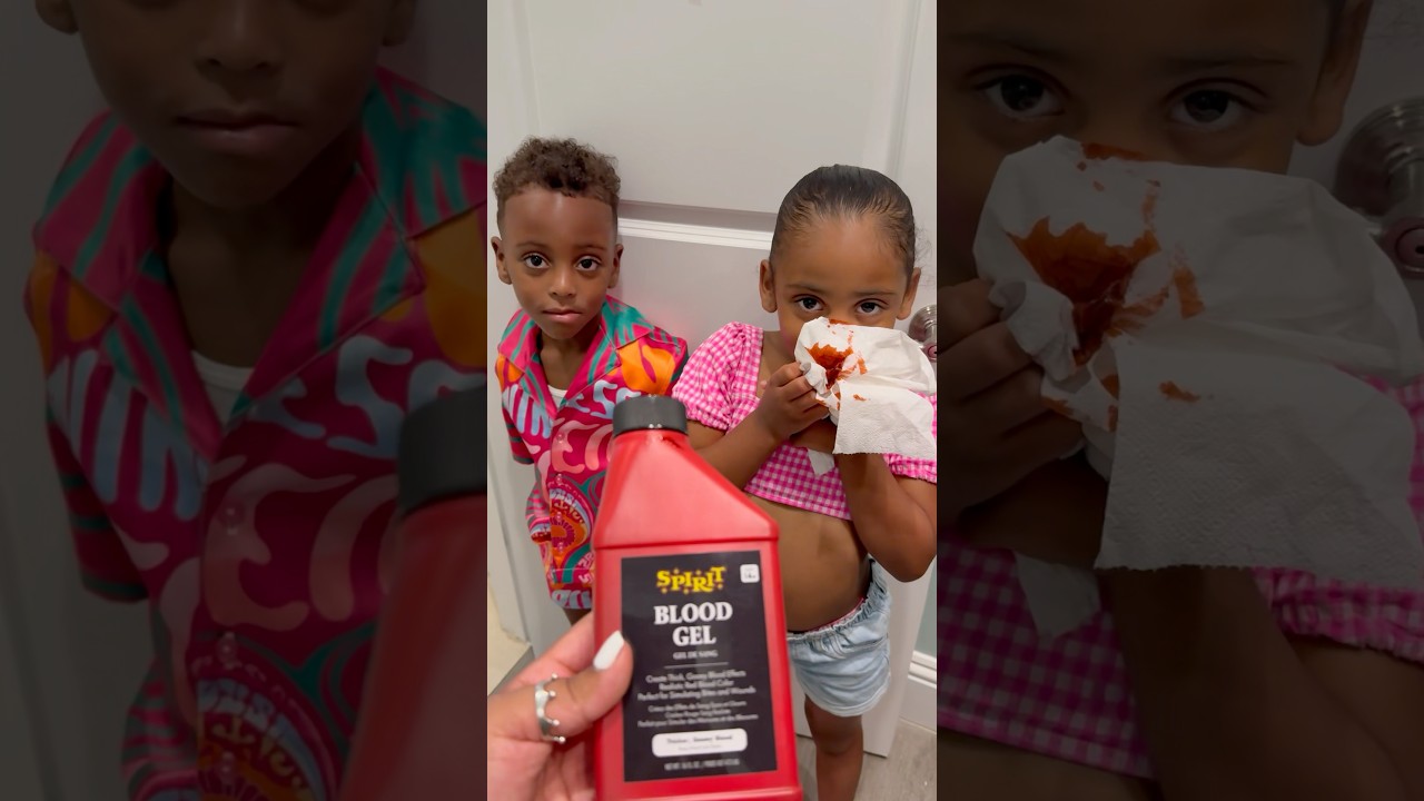 Hilarious London Nose Bleed Prank on Dad! 😂 #Shorts