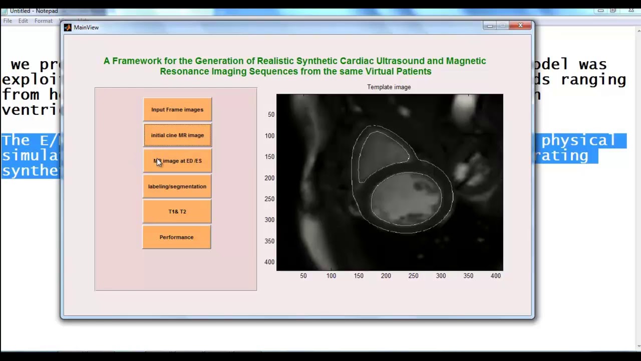 Image Processing Projects with MATLAB ๐ธ