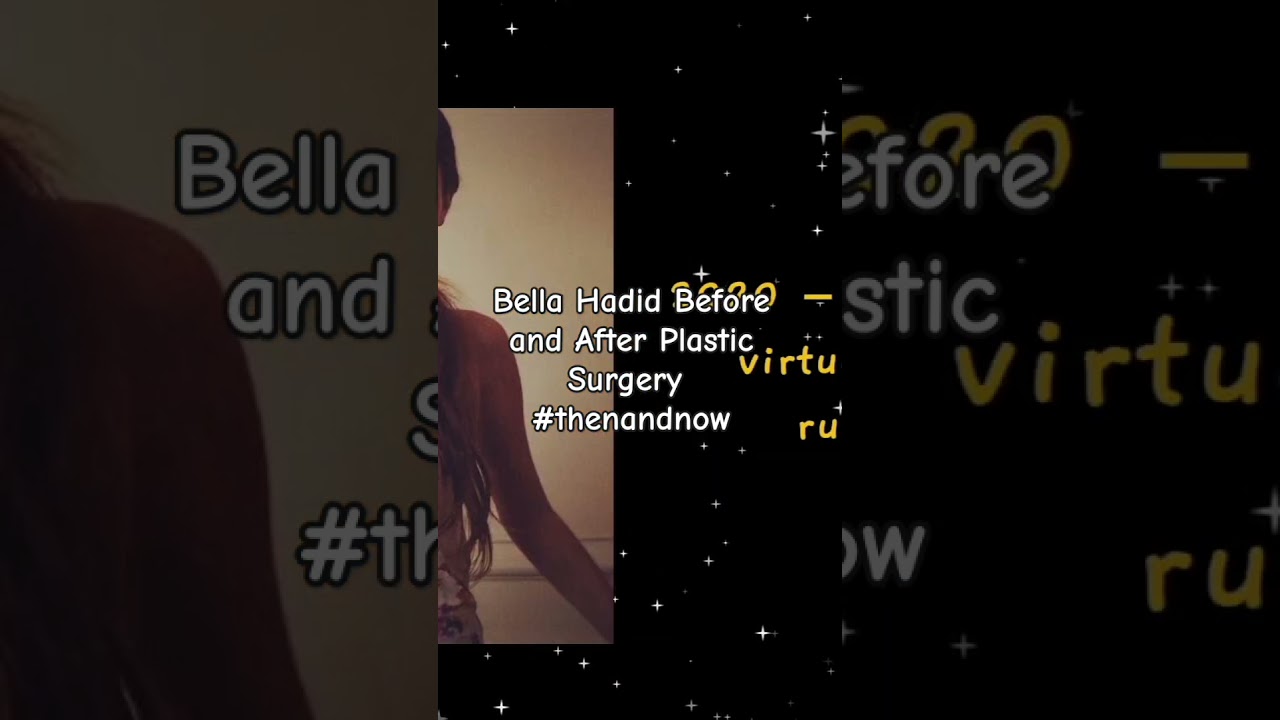 Bella Hadid's Stunning Transformation: Before and After Plastic Surgery β¨