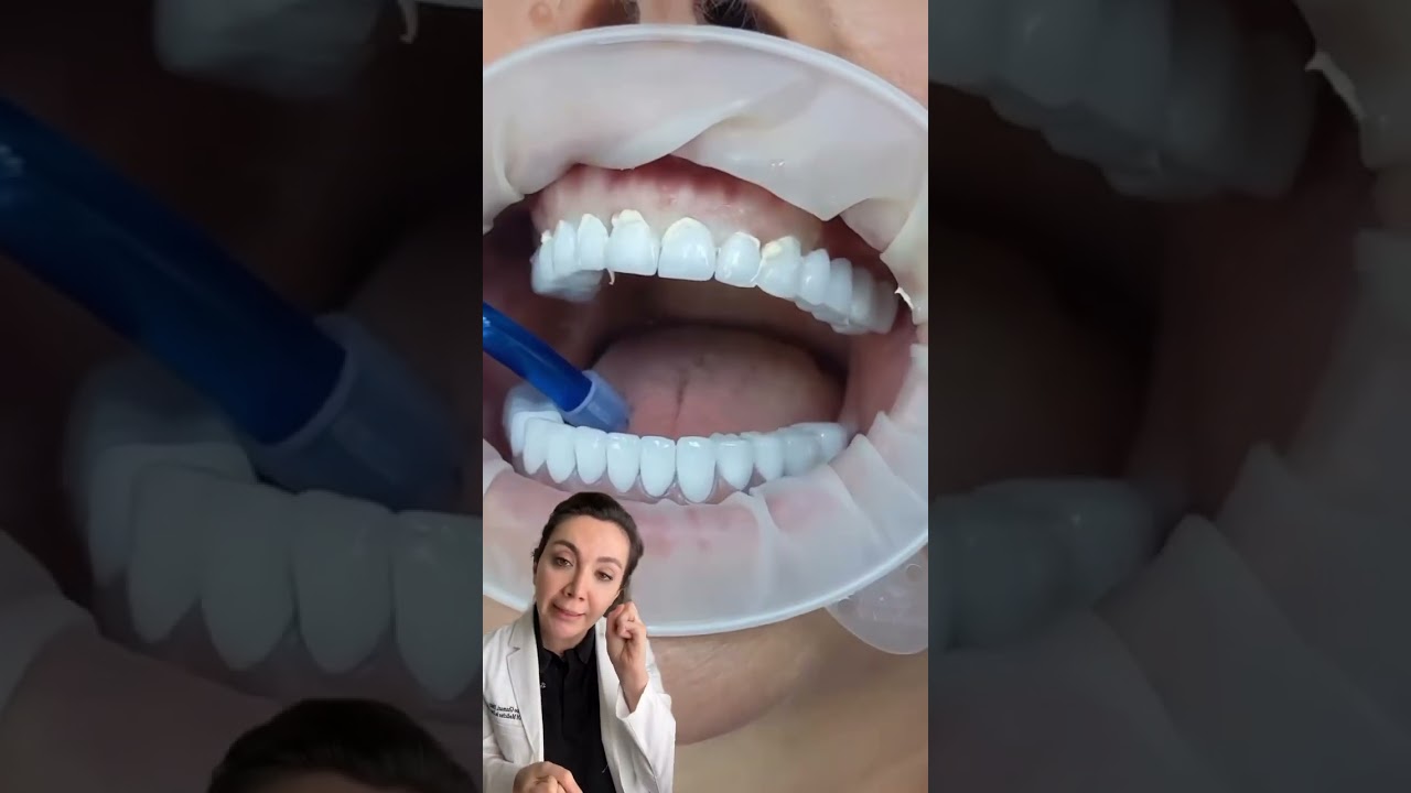 What Are Dental Crowns Used For? 🦷