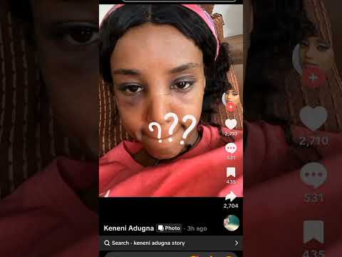 Keneni Adugna - ቀነኒ አዱኛ #andualem_gosa #keneniadugna #bilillee #oromo #oromomusic #andualemgosa