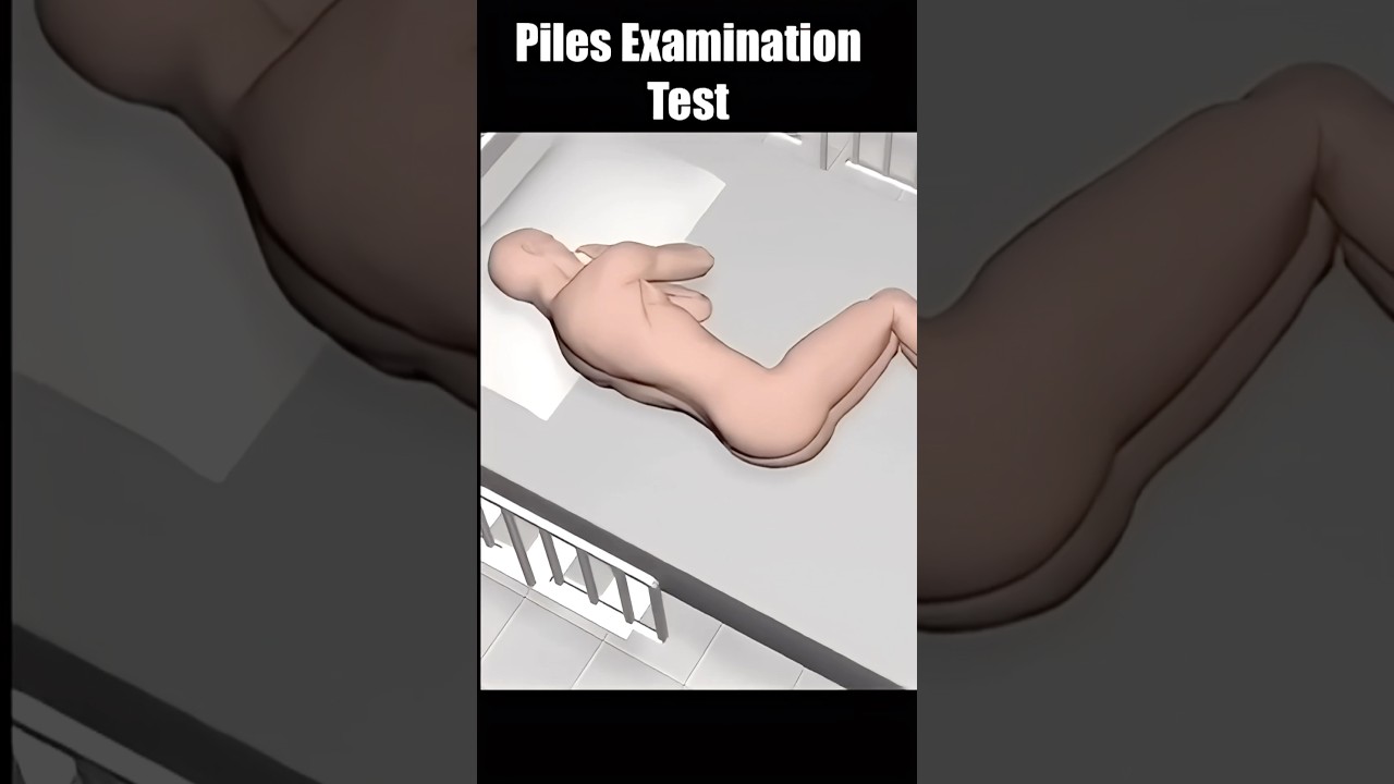 Surgeon Examines Piles in 3D Animation 🎥