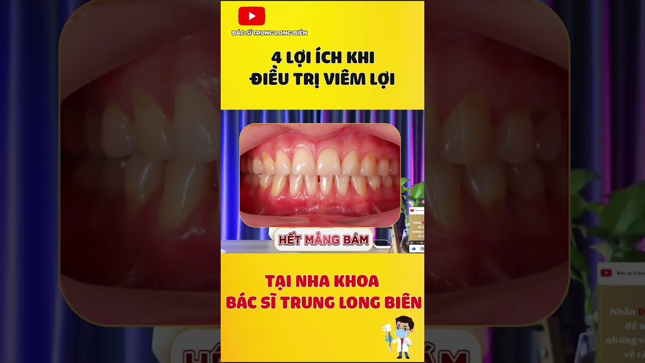 4 Lợi Ích Của Việc Chữa Viêm Lợi #shorts