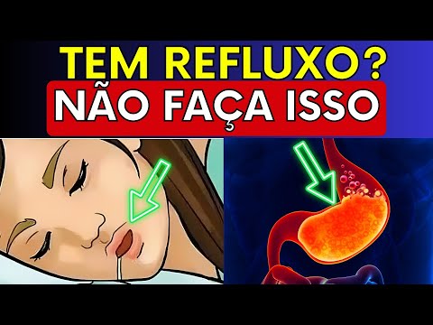 Solucionando Refluxo e Azia de Forma Simples