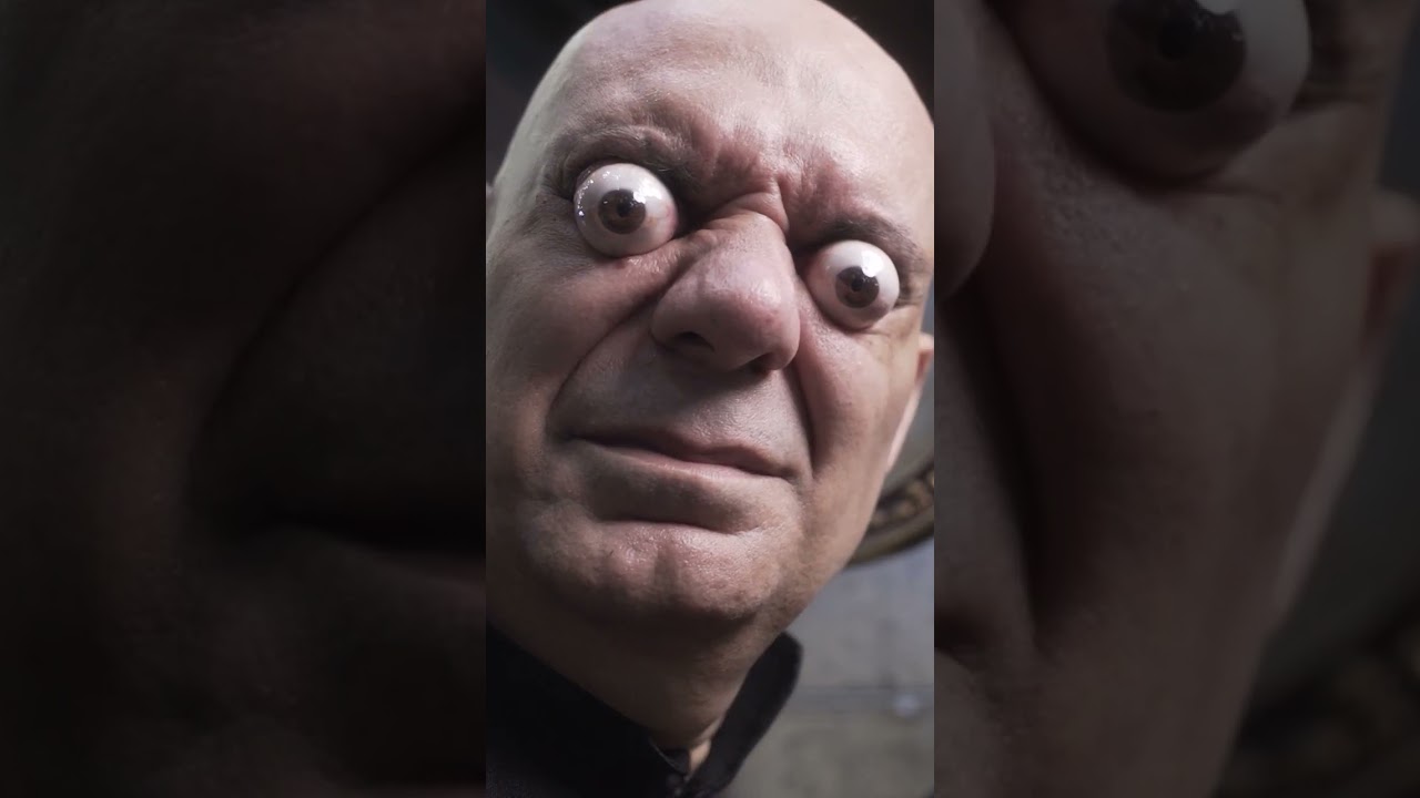 Record-Breaking Eyeball Pop! 👀 Farthest Distance at 18.2 mm by Sidney de Carvalho Mesquita