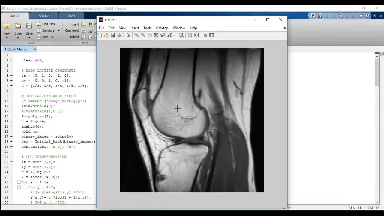 Top Matlab Image Processing Project Ideas πΈ