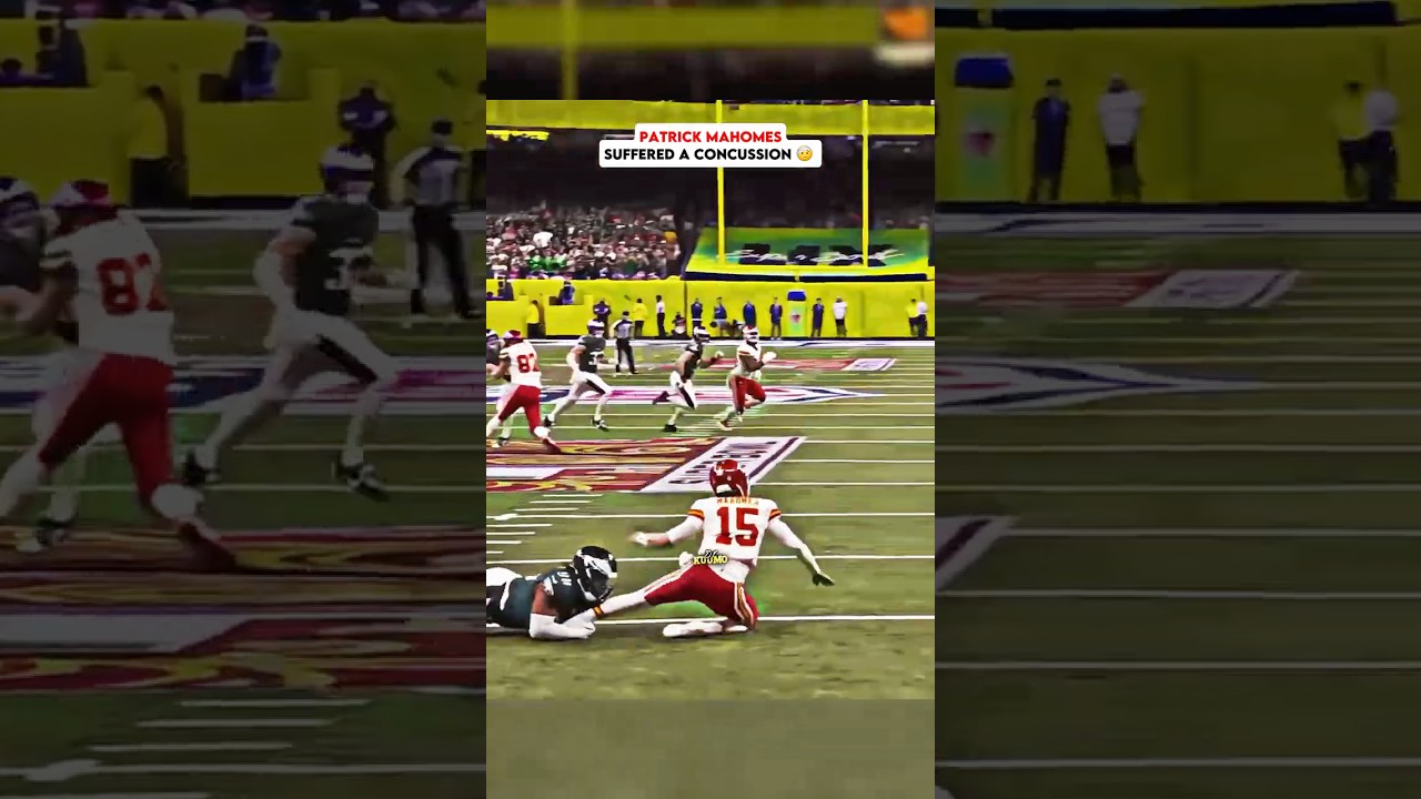 Why the Chiefs Fell Short in Super Bowl 😢