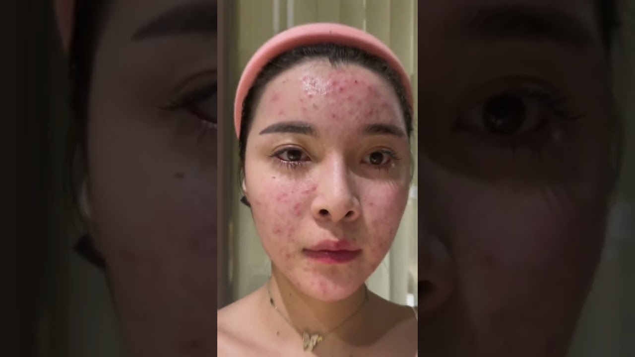 피부관리의 핵심 비밀 공개! ✨ 건강한 피부를 위한 필수 팁