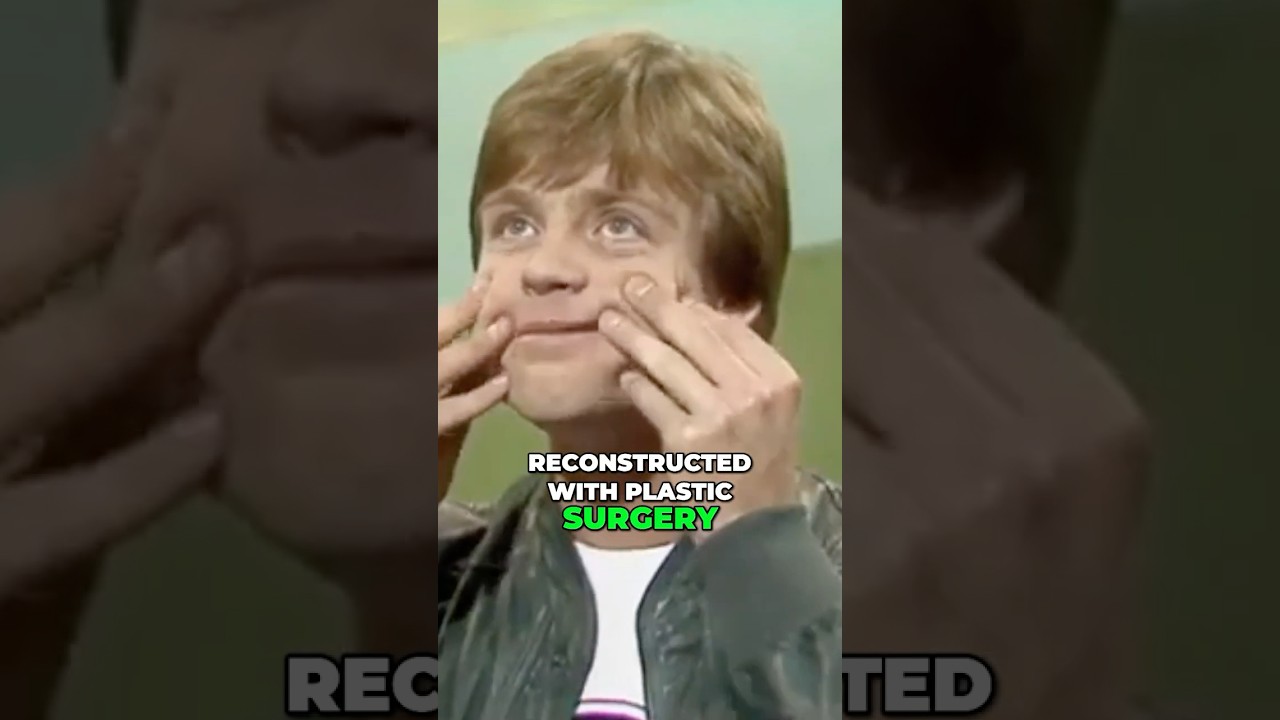 Why Mark Hamill Face Changed Between Episode 4 & 5