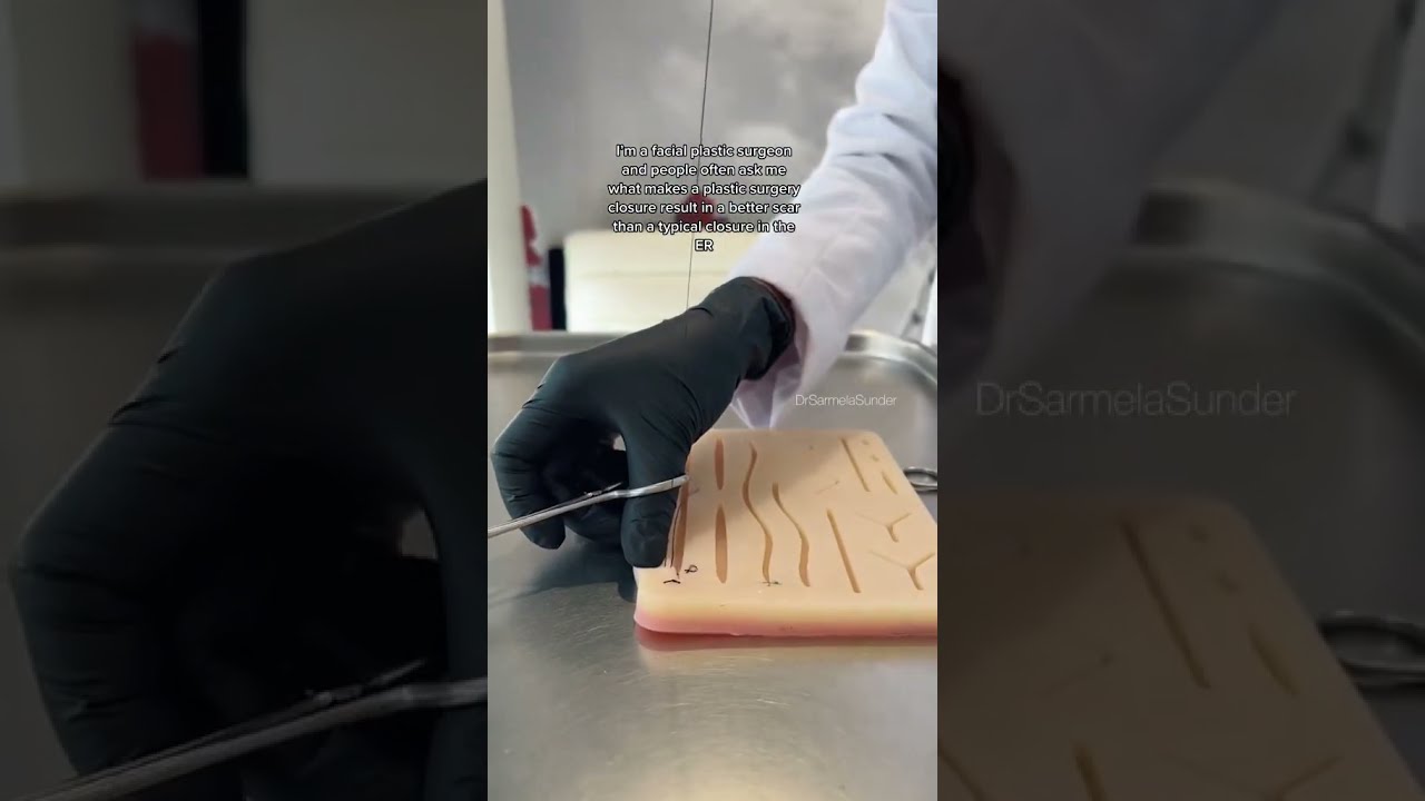 Facial Plastic Surgeon's Suture Technique | #shorts