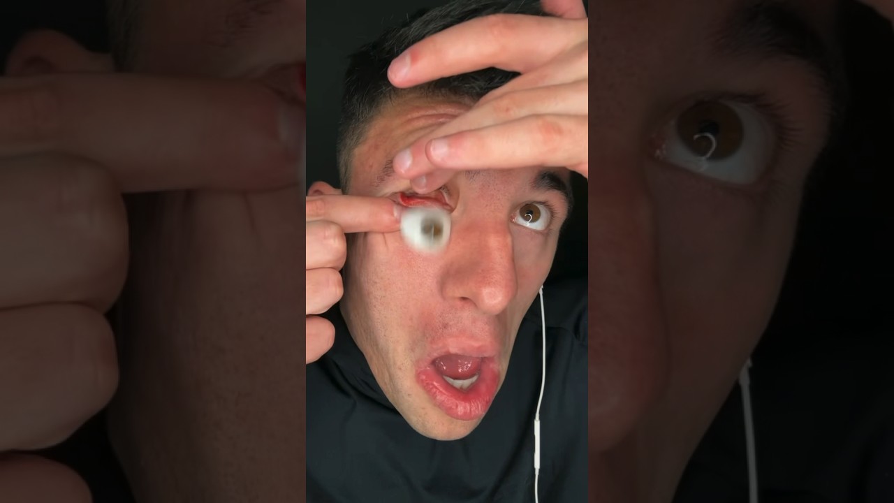 MY EYEBALL POPPED OUT π³