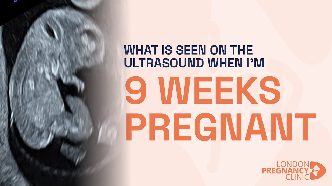 Week 9 Pregnancy Ultrasound: Brain, Heart & Gender