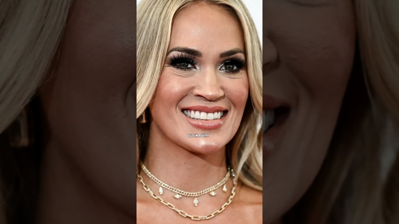A Dive into Carrie Underwood's Plastic Surgery #celebrity #doctor #plasticsurgery #carrieunderwood