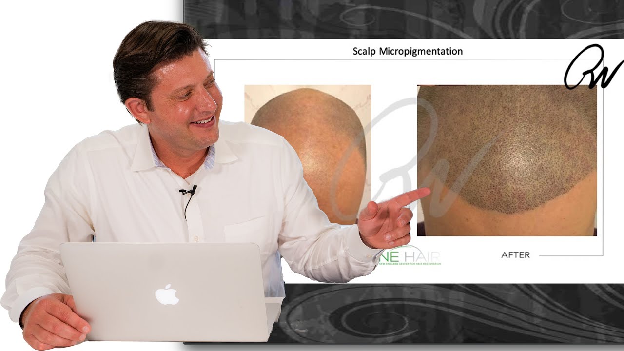 Is Scalp Micropigmentation Worth It? | NEHair®
