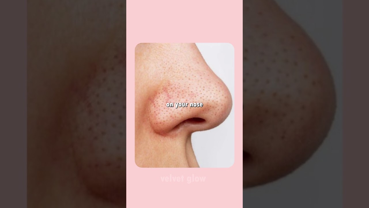 Must-Know Vaseline Hacks for Flawless Skin & Hair ✨