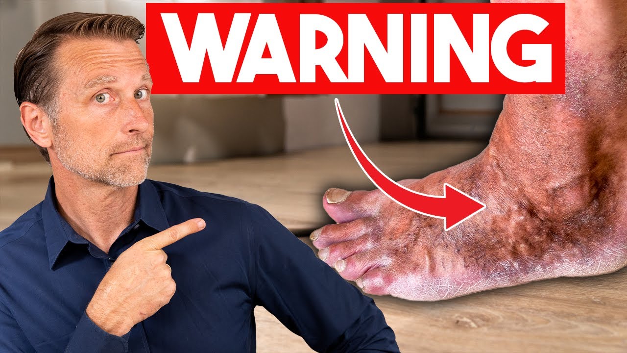 What Your Feet Reveal About Your Health 🦶