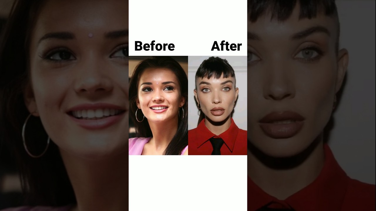 Amy Jackson's Plastic Surgery Transformation ✨