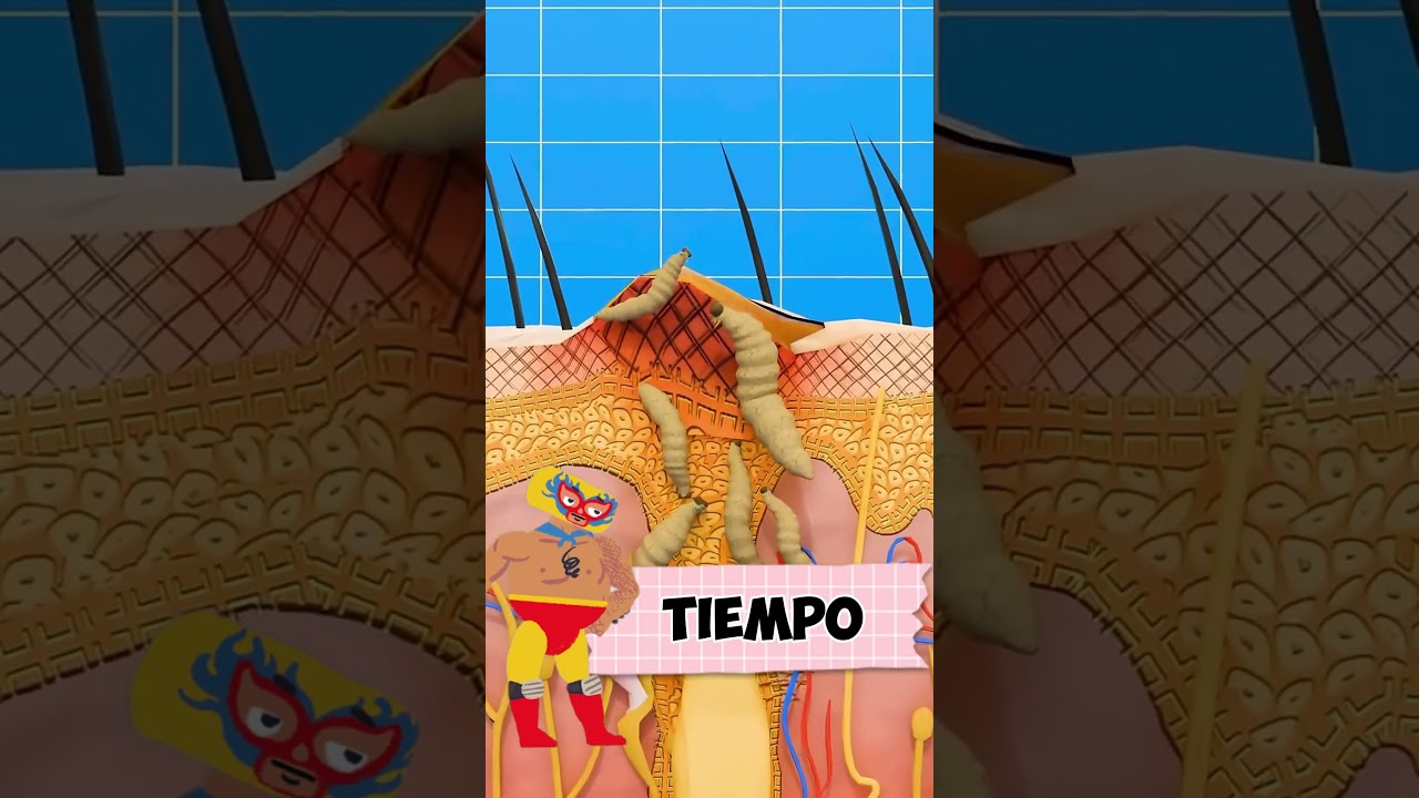 ¿Qué pasa cuando moscas dejan huevos en tu piel? 🪰