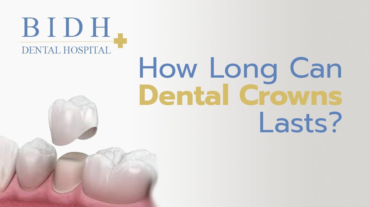 Dental Crown Lifespan | BIDH Dental Sukhumvit 🦷