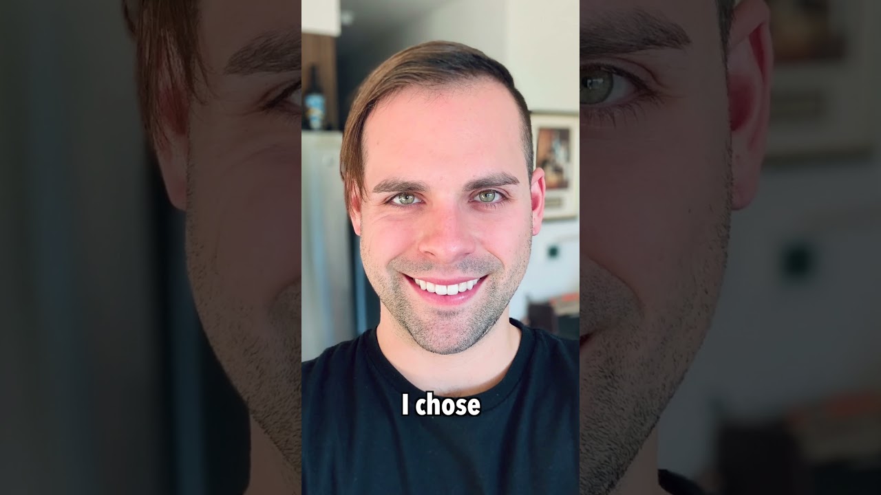 My Journey Through Balding Solutions 🚫