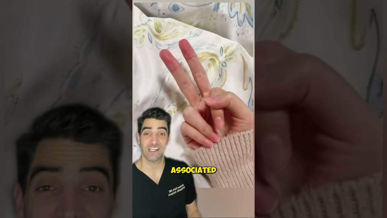 Extra Fingers: Causes & Treatments 🖐️