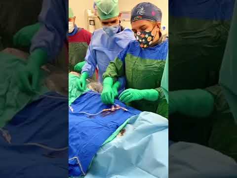 Karotis (Şah Damarı) Ameliyatı