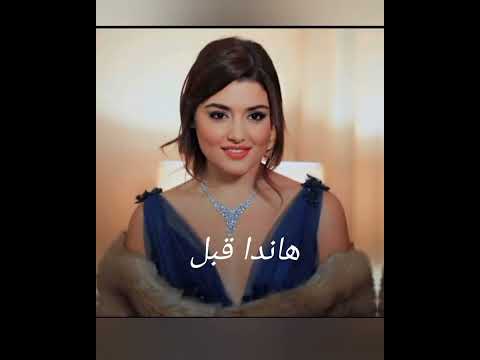 هاندا ارتشيل قبل و بعد الشهرة (عمليات تجميل) 😍🇹🇷🇹🇷♥🌹