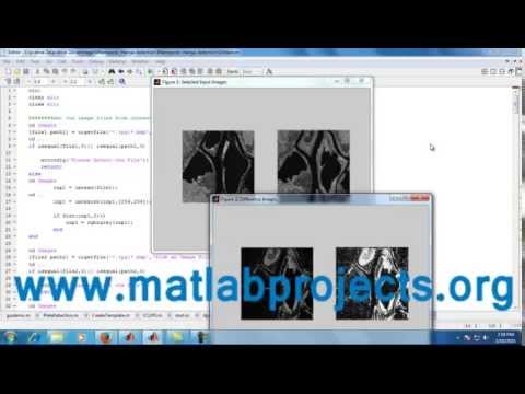 Change Detecion Using SAR Image Processing Matlab Projects