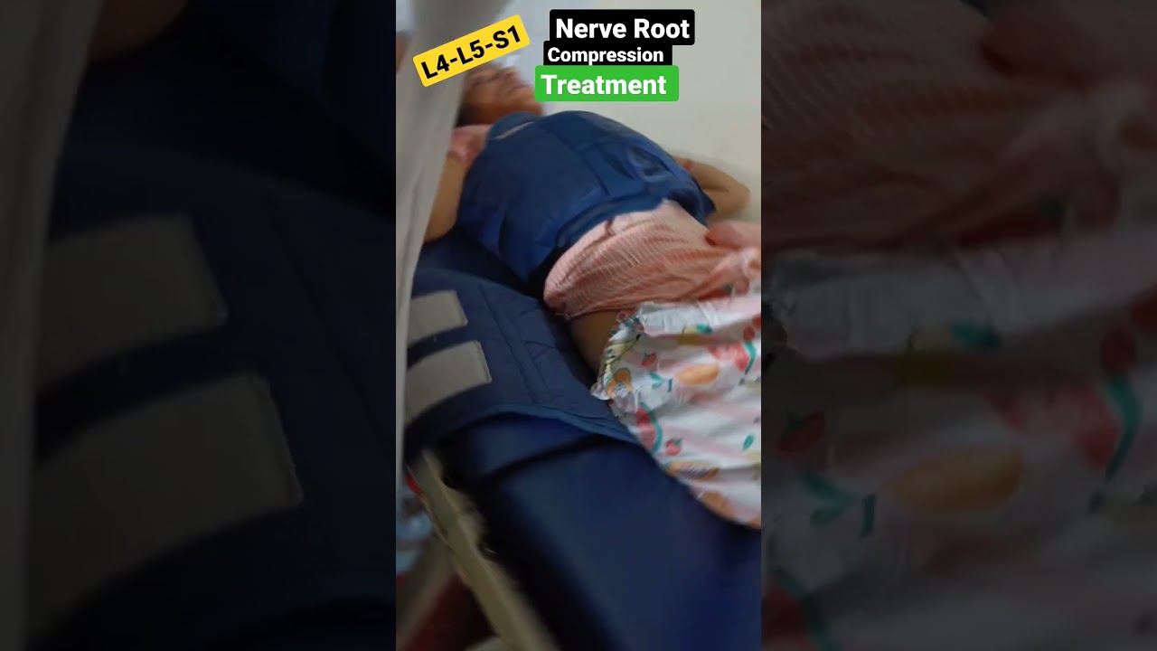 L4-L5-S1 Nerve Root Compression Relief 🩺