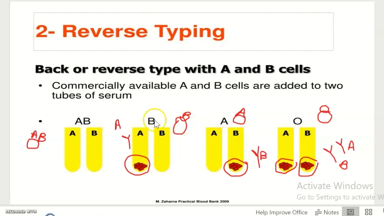 Reverse Blood Grouping Procedure and Memory Tips