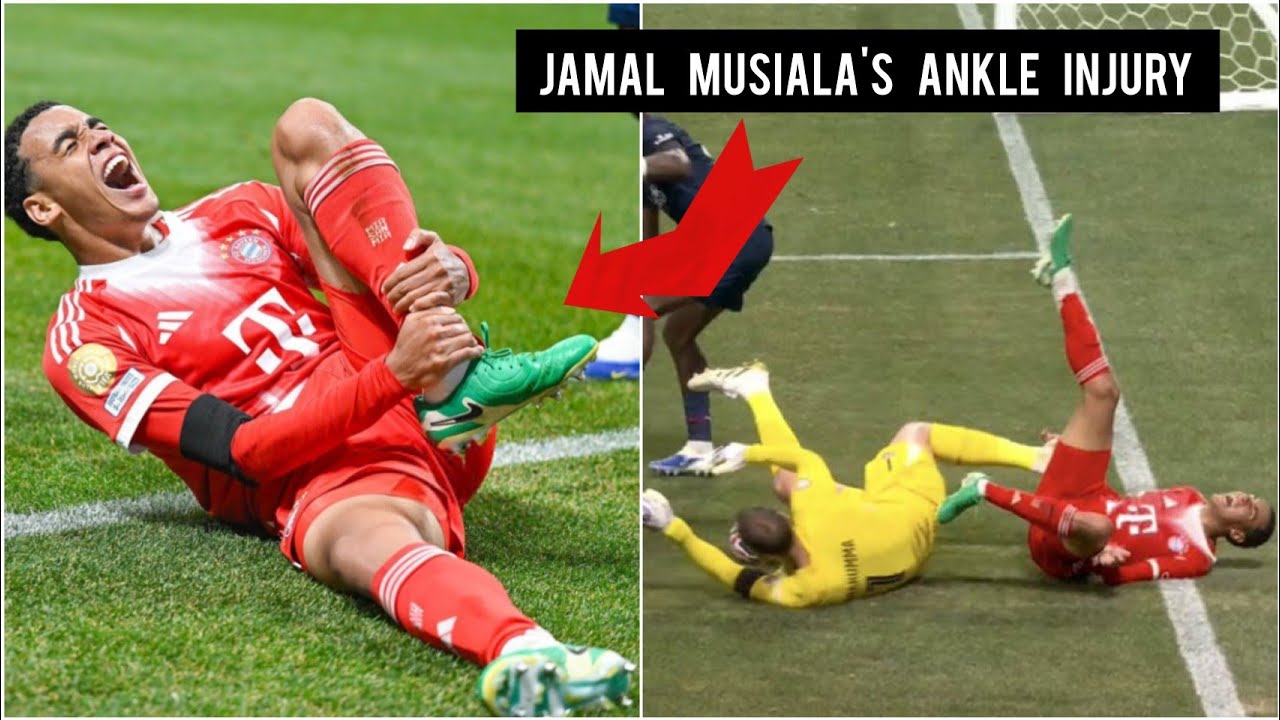 Musiala Collides with Donnarumma, Injures Ankle vs PSG ⚽