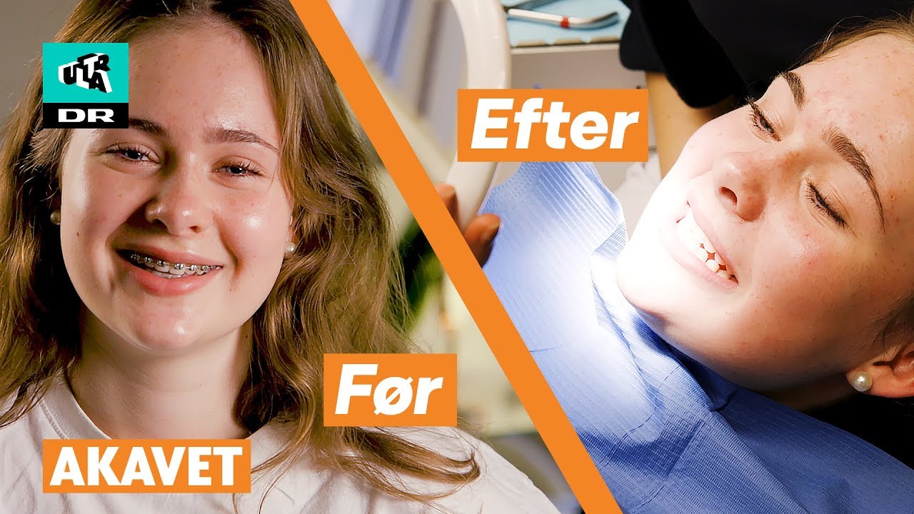 Sarah viser sig uden bøjle for første gang! 😅