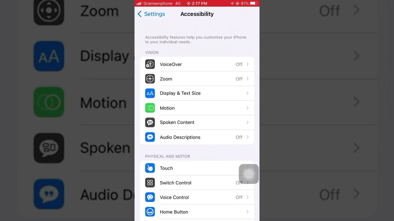 No Auto-Brightness on iPhone? 🤔