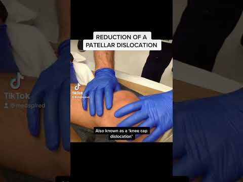 Reduction of a Patellar Dislocation