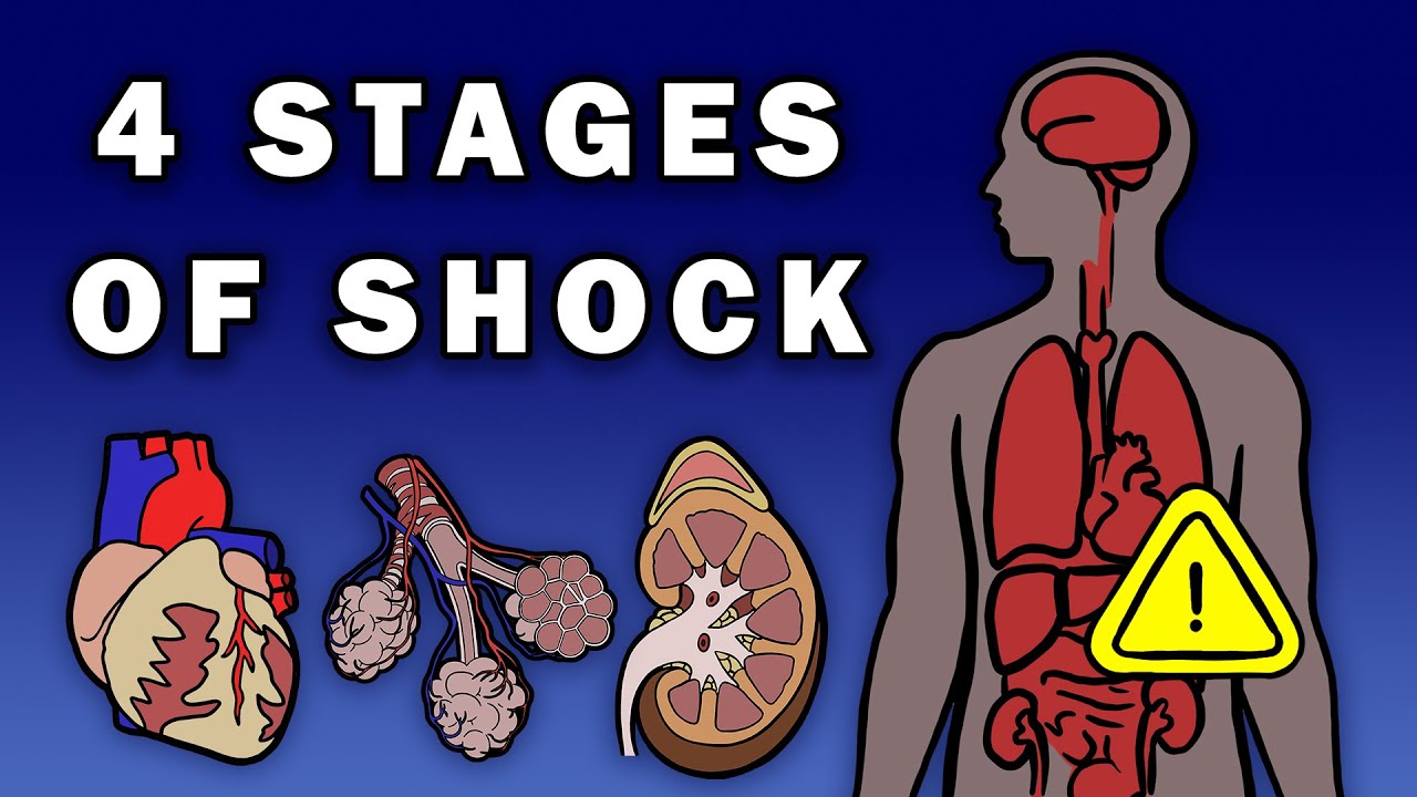 THE 4 4 Stages of Shock: Recognize & Respond 🚑