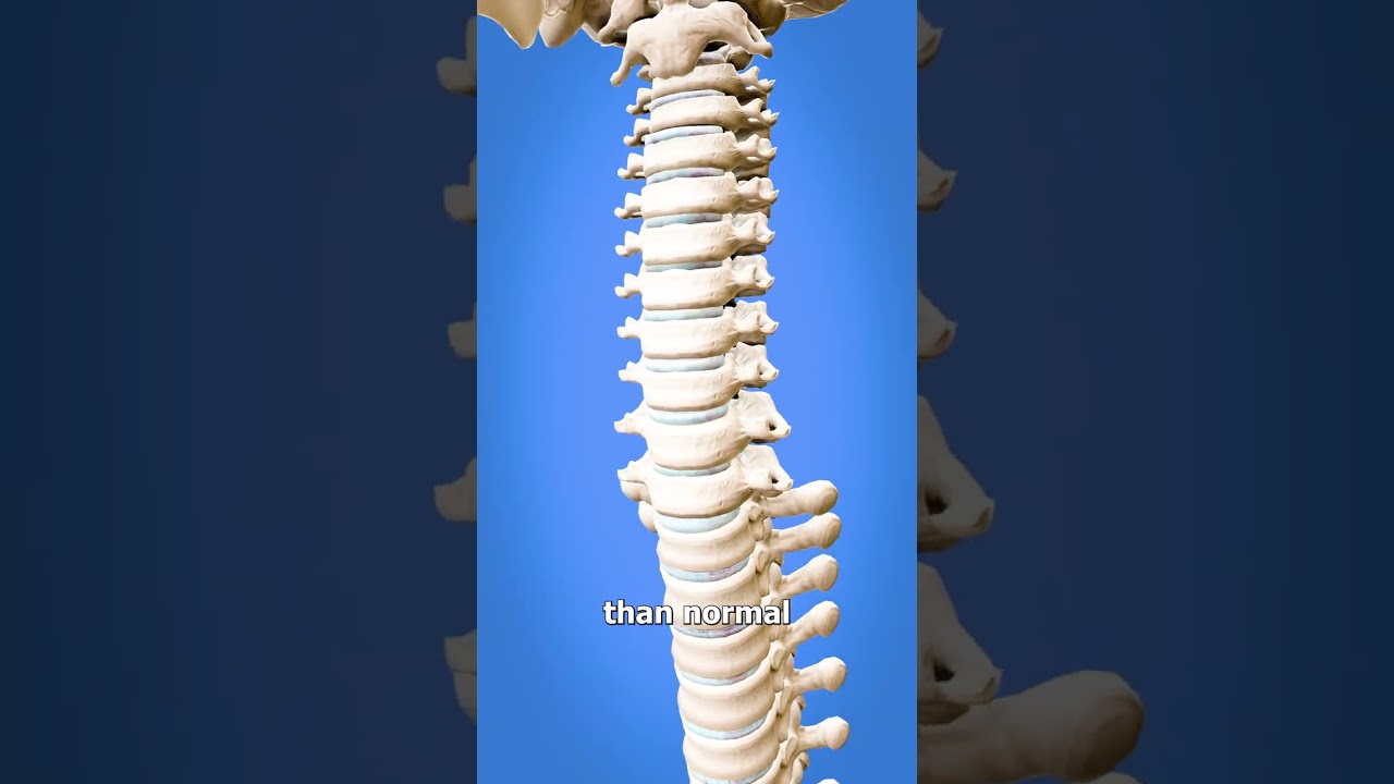 Learn to Spin Your Head Like an Owl 🦉