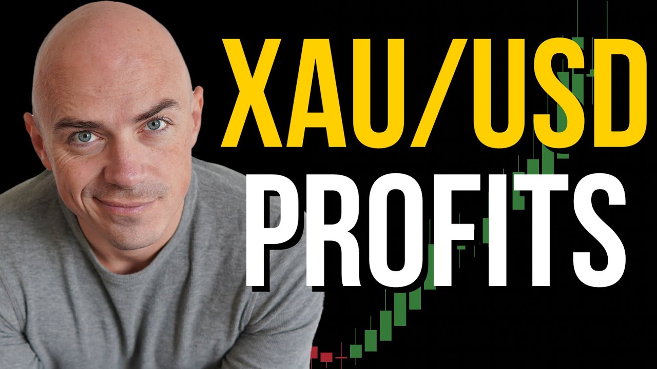 Trade Gold & Catch Big Trends 📈